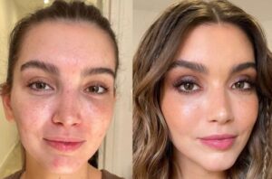 apps para editar orejas